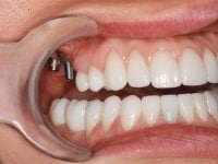 Konig Center for Cosmetic & Comprehensive Dentistry smile photos